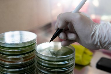 Petri kabında miselyum egzotik mantar. Miselyumun seçilmesi ve yetiştirilmesi. Dünya çapında mantar yetiştirme