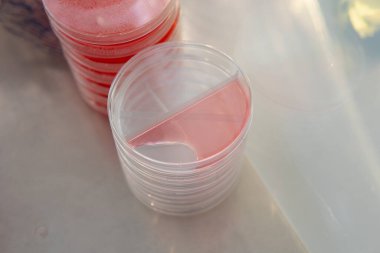 Agar 'lı petri kapları. Mikoloji ve Miselyum