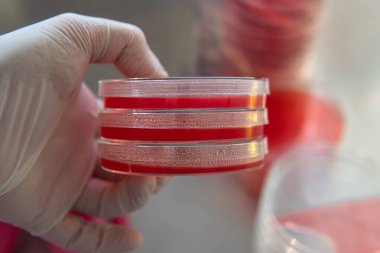 Agar 'lı petri kapları. Mikrobiyoloji ve miselyum