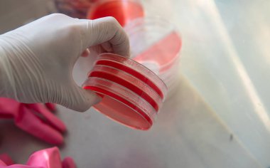 Agar 'lı petri kapları. Mikrobiyoloji ve miselyum