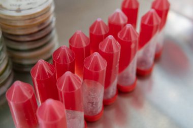 Santrifüj tüpü ve miselyumun gelişmesi için besin maddesi. Profesyonel mitoloji, mantar kültürü