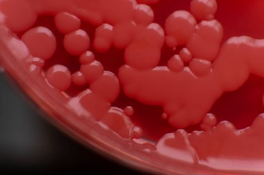 Küf ve bakteri kırmızıda. Patojenler için tarım aracı. Küf sporları ve miselyum