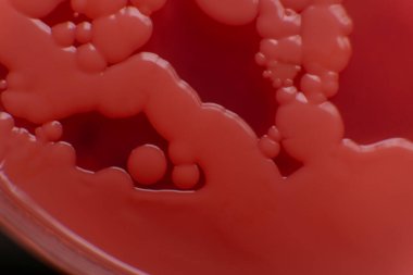 Petri kabında küf. Laboratuvar koşullarında mikrobiyolojik çalışmalar. Miselyum ve küf.