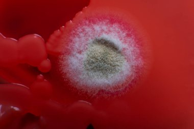 Petri kabında küf var. Küfün dünyadaki yiyecek stokları üzerindeki zararlı etkisi.