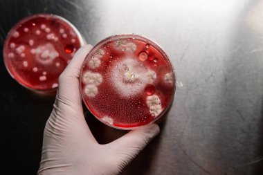 Küf ve bakterileri kırmızı agarlı bir petri kabında incelemek. Küf sporları ve mantar miselyumu