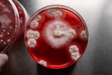 Petri kabında küf. Laboratuvar koşullarında mikrobiyolojik çalışmalar. Miselyum ve küf.