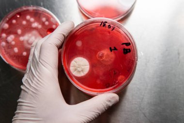 Petri kabında küf. Laboratuvar koşullarında mikrobiyolojik çalışmalar. Miselyum ve küf.