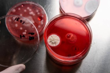 Petri kabında küf. Laboratuvar koşullarında mikrobiyolojik çalışmalar. Miselyum ve küf.