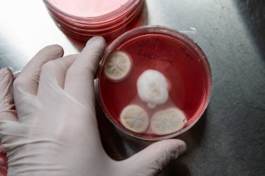 Petri kabında küf. Laboratuvar koşullarında mikrobiyolojik çalışmalar. Miselyum ve küf.