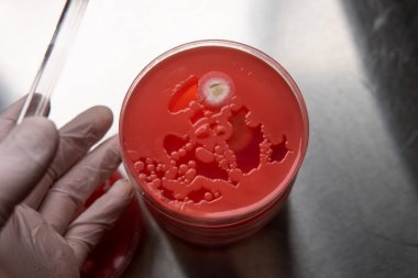 Petri kabında küf var. Küfün dünyadaki yiyecek stokları üzerindeki zararlı etkisi.