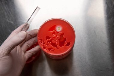 Petri kabında küf. Laboratuvar koşullarında mikrobiyolojik çalışmalar. Miselyum ve küf.