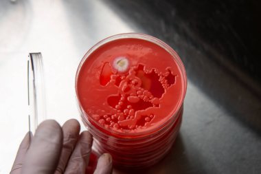 Petri kabında küf var. Küfün dünyadaki yiyecek stokları üzerindeki zararlı etkisi.