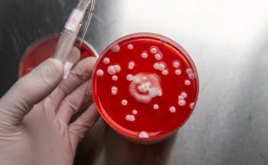 Petri kabında mantar miselyumu, tarım besin maddeleri üzerine..