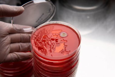 Petri kabında küf. Laboratuvar koşullarında mikrobiyolojik çalışmalar. Miselyum ve küf.