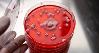 Küf ve bakteri kırmızıda. Patojenler için tarım aracı. Küf sporları ve miselyum