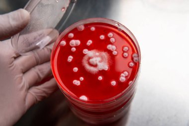 Petri kabında küf. Laboratuvar koşullarında mikrobiyolojik çalışmalar. Miselyum ve küf.