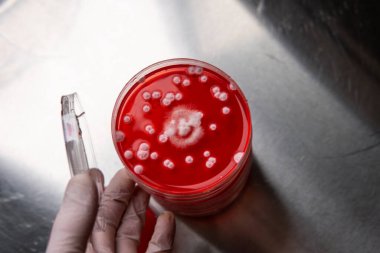 Petri kabında küf. Laboratuvar koşullarında mikrobiyolojik çalışmalar. Miselyum ve küf.