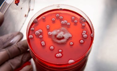 Petri kabında küf. Laboratuvar koşullarında mikrobiyolojik çalışmalar. Miselyum ve küf.