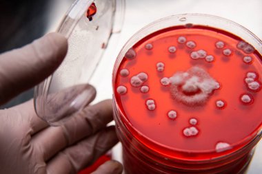 Petri kabında küf var. Küfün dünyadaki yiyecek stokları üzerindeki zararlı etkisi.