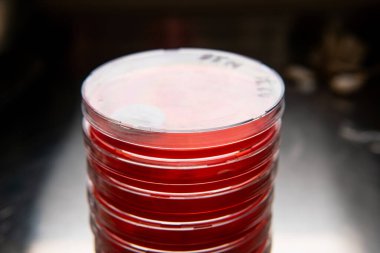 Petri kabında küf. Laboratuvar koşullarında mikrobiyolojik çalışmalar. Miselyum ve küf.