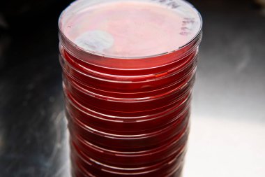 Küf ve bakterileri kırmızı agarlı bir petri kabında incelemek. Küf sporları ve mantar miselyumu