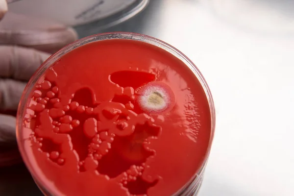 Pleśń Bakterie Czerwonym Agarze Agar Medium Dla Patogenów Zarodniki Pleśni — Zdjęcie stockowe