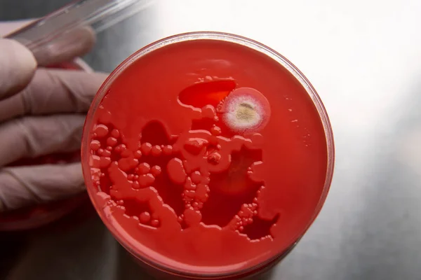 Вивчення Цвілі Бактерій Чашці Петрі Червоним Агаром Спори Цвілі Грибковий — стокове фото