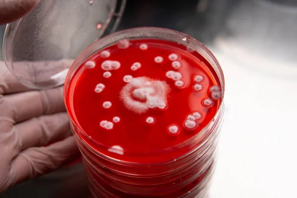 Вивчення Цвілі Бактерій Чашці Петрі Червоним Агаром Спори Цвілі Грибковий — стокове фото
