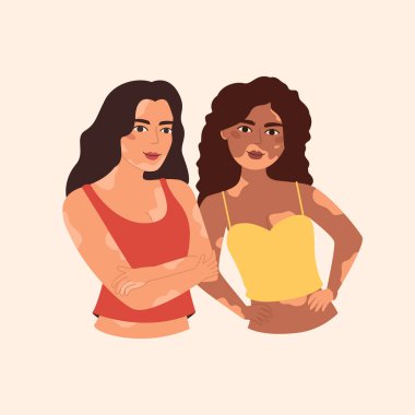 Vitiligo insanları, farklı güzellik ve vücut pozitifliği.