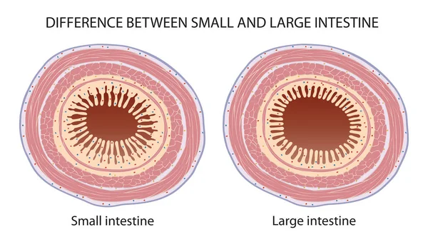 Diferença Entre Intestino Pequeno Grande — Fotografia de Stock