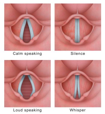 Vocal cord (vocal folds) vibratory cycle clipart