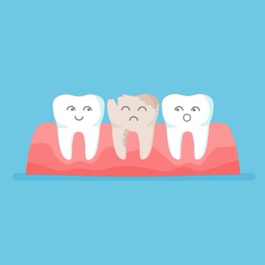 Caries 'li dişler. Pamuk Prenses mutlu şirin ve sarı üzgün çirkin diş. Beyazlatmadan önce ve sonra. Diş sağlığı konsepti. Mavi arkaplanda vektör illüstrasyonu izole edildi