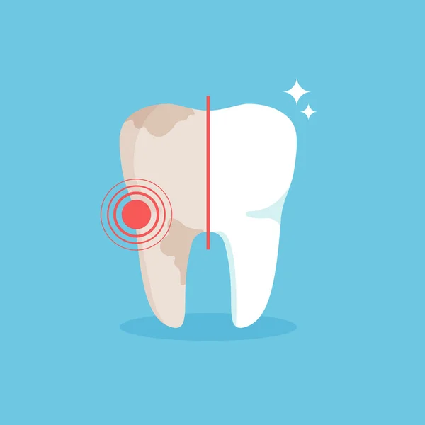 Borsta Tänderna Sjuk Tand Före Och Efter Behandling Begreppet Tandhälsa — Stock vektor