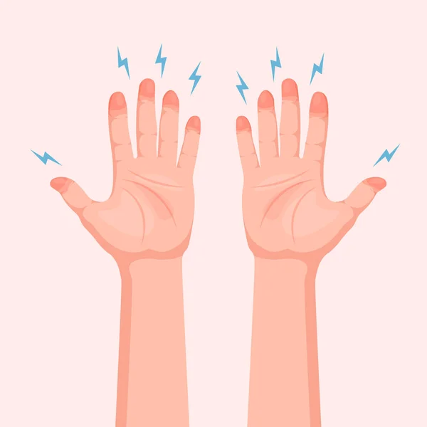 Frozen Hands Fingers Medical Frostbite Skin Burn Symptom Vector Illustration — Stock vektor