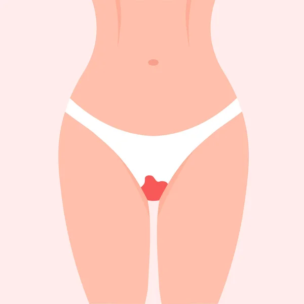 Vrouw Dijen Met Bloed Bevlekte Slipjes Periode Macht Menstruatiedag Menstruatieconcept — Stockvector