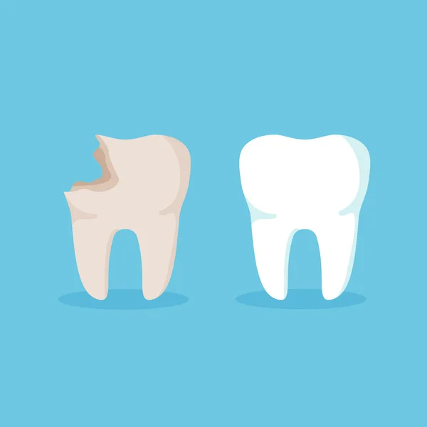 Очищення Зубів Хворий Зуб Після Лікування Карієсу Концепція Стоматологічного Здоров — стоковий вектор