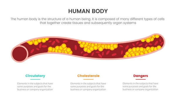 Cholesterin Menschliche Anatomie Infografisches Konzept Für Diapräsentation Mit Punkte Liste — Stockvektor