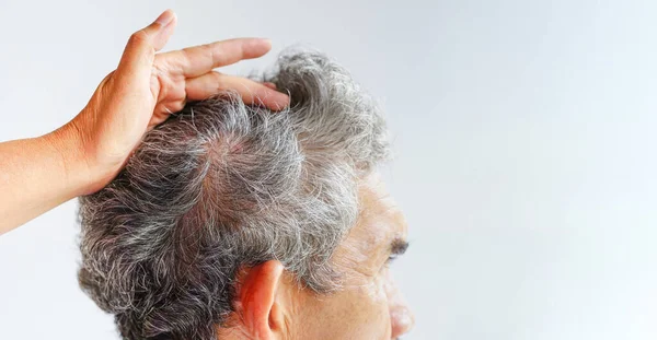 grey hair in an old age man(selective focus), beautician open gray hair of a senior man to show hair problem isolated on grey background with copy space