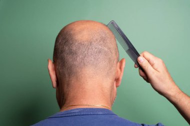 view from behind of a bald man while he combs his hair