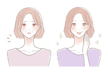 Orta yaşlı bir kadının boynundaki kırışıklıklardan önce ve sonra. Beyaz arkaplanda.