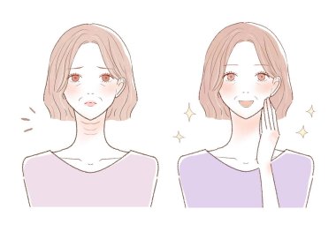 Orta yaşlı bir kadının boynundaki kırışıklıklardan önce ve sonra. Beyaz arkaplanda.