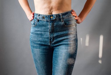 Kot pantolon giymiş ince kadın kalçaları. Ellerin kalçada olsun. Karın derisinde gerilme izleri var..