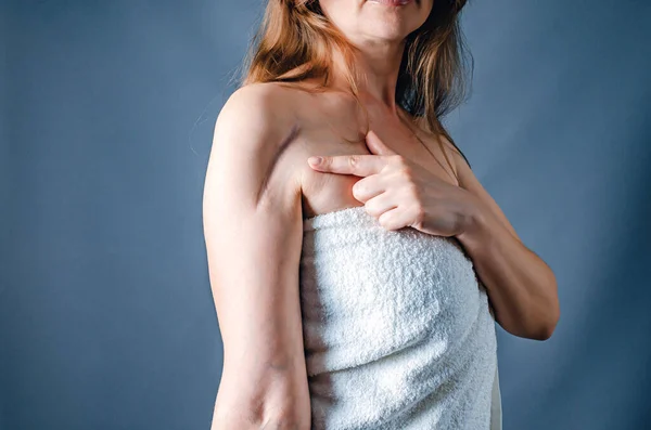 Side View Woman Towel Shows Finger Scar Hand Surgery Treatment — Stock Photo, Image