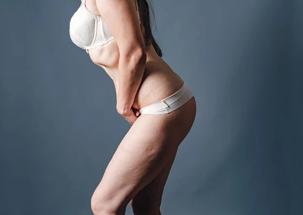 Beyaz Giysili Kadın Ellerini Bacaklarının Arasına Sıkıştırdı Jinekolojik Sorunlar Idrar — Stok fotoğraf