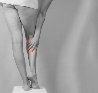 Rear view long female bare legs. . A woman's hand touches her leg bent at knee. Pain in leg.