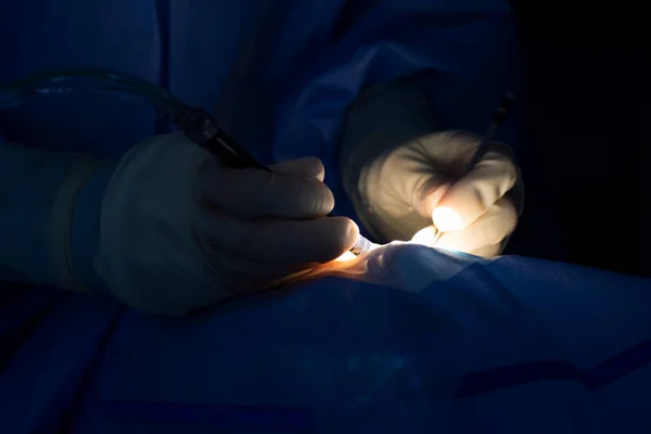 Close Das Mãos Oftalmologista Operando Uma Catarata Com Uma Sonda — Fotografia de Stock