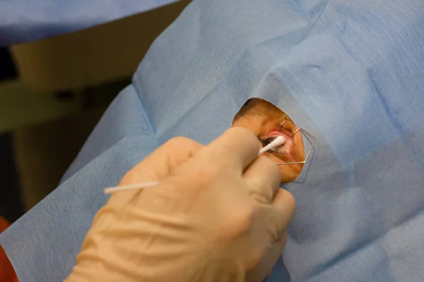 Close Human Eye Ophthalmology Operating Room Pressing Isopod Intravitreal Injection — Stock Photo, Image