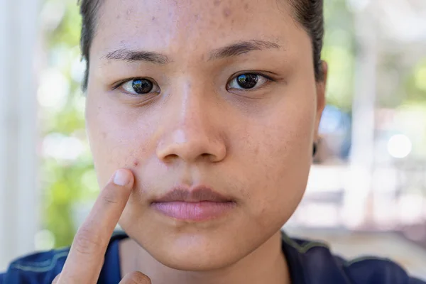 Jeune Femme Asiatique Inquiète Son Visage Quand Elle Des Problèmes — Photo