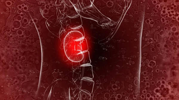 腎臓痛のコンピュータによる人間の解剖図 — ストック写真