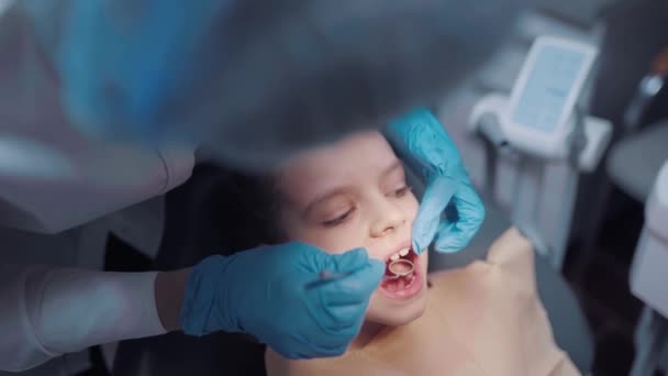 Primo piano viso di bambina paziente con bocca aperta durante il controllo dentale prevenzione mal di denti. — Video Stock